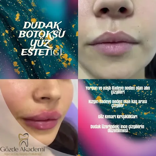 Özel Gözde Akademi Ağız Ve Diş Sağlığı Polikliniği