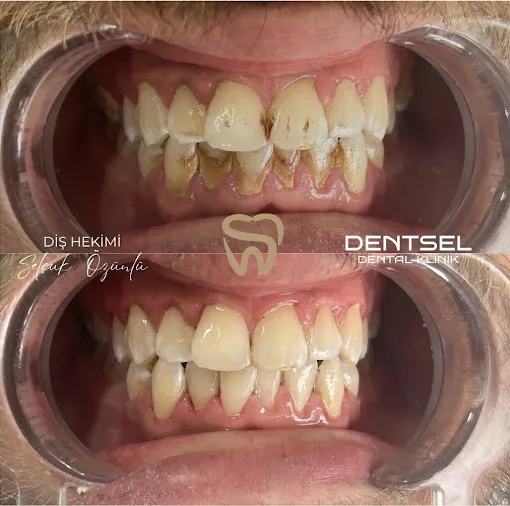 Özel Dentsel Ağız Ve Diş Sağlığı Polikliniği, Afyonkarahisar – Diş Kliniği fotoğrafı 2