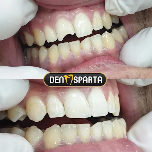 Dentısparta Ağız Ve Diş Sağlığı Polikliniği